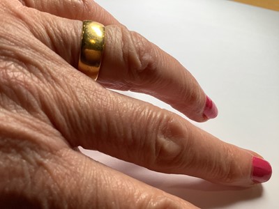 Lot 105 - A 22 carat yellow gold wedding band.